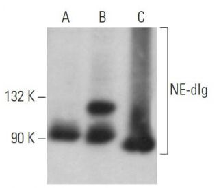 NE-dlg Antibody (D-6) - Western Blotting - Image 366841 