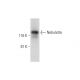 Nebulette Antibody (E-12) - Western Blotting - Image 298584