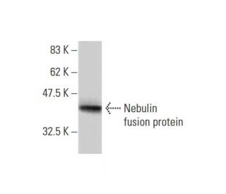 Nebulin Antibody (1F4) - Western Blotting - Image 348555