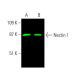 western blotting image from recommended Nectin 1 (CK6) monoclonal antibody replacement. Image 381977