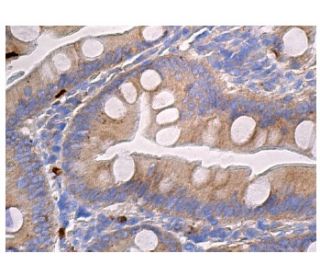 Nectin 2 Antibody (D-11) - Immunohistochemistry - Image 160986 