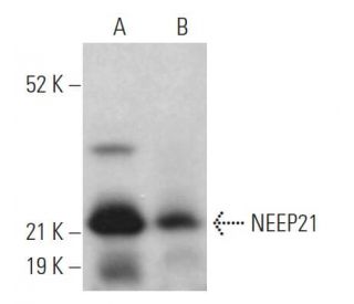 NEEP21 Antibody (H-9) - Western Blotting - Image 370896 