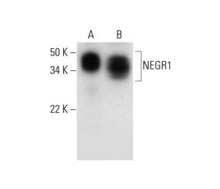 NEGR1 Antibody (H-12) - Western Blotting - Image 294525SAM Transcription Activation: SAM system utilizing dCas9-VP64, MS2-P65-HSF1, and sgRNA for precise gene transcription activation.