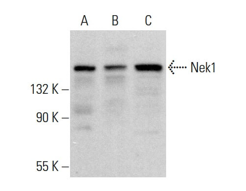 Nek1 Antibody (E-10) | SCBT - Santa Cruz Biotechnology