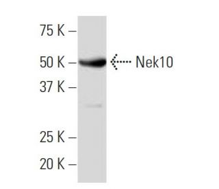 Nek10 Antibody (97.1) - Western Blotting - Image 33807 