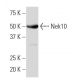 Nek10 Antibody (97.1) - Western Blotting - Image 33807 