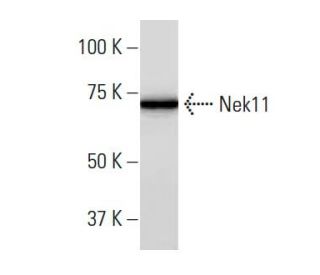 Nek11 Antibody (36JK) - Western Blotting - Image 33802SAM Transcription Activation: SAM system utilizing dCas9-VP64, MS2-P65-HSF1, and sgRNA for precise gene transcription activation.