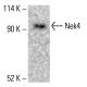 Nek4 Antibody (2631C1a) - Western Blotting - Image 412702