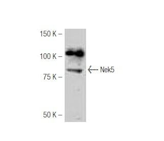 Nek5 Antibody (OC-65) - Western Blotting - Image 53992