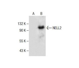 NELL2 Antibody (E-9) - Western Blotting - Image 286775 