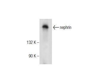western blotting image from recommended nephrin (G-8) monoclonal antibody replacement. Image 155805