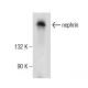 Cet anticorps polyclonal n'est plus commercialisé. Voir l'anticorps monoclonal <a href="nephrin-antibody-g-8">nephrin (G-8)</a> que nous recommandons (données d'échantillonnage indiquées). western blotting image from recommended nephrin (G-8) monoclonal antibody replacement. Image 155805