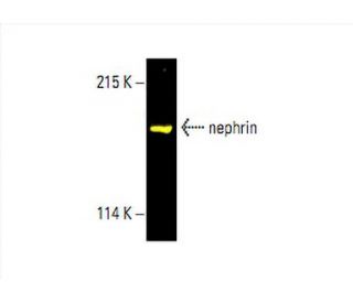nephrin Antibody (B-12) - Western Blotting - Image 393691