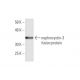 nephrocystin-3 Antibody (3B1) - Western Blotting - Image 349562