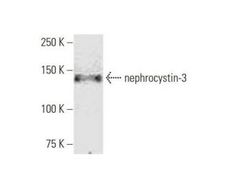 nephrocystin-3 Antibody (3B1) - Western Blotting - Image 352187 