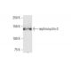 nephrocystin-3 Antibody (3B1) - Western Blotting - Image 352187 