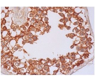 nephrocystin Antibody (D-9) - Immunohistochemistry - Image 284851 