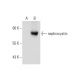 nephrocystin Antibody (D-9) - Western Blotting - Image 129833