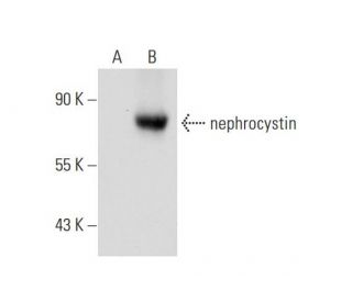 nephrocystin Antibody (D-9) - Western Blotting - Image 129833SAM Transcription Activation: SAM system utilizing dCas9-VP64, MS2-P65-HSF1, and sgRNA for precise gene transcription activation.