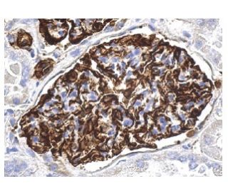 nestin Antibody (10c2) | SCBT - Santa Cruz Biotechnology