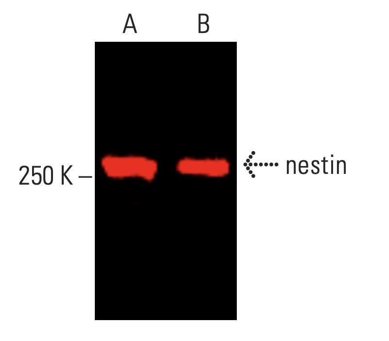 nestin抗体(10c2) | SCBT - Santa Cruz Biotechnology