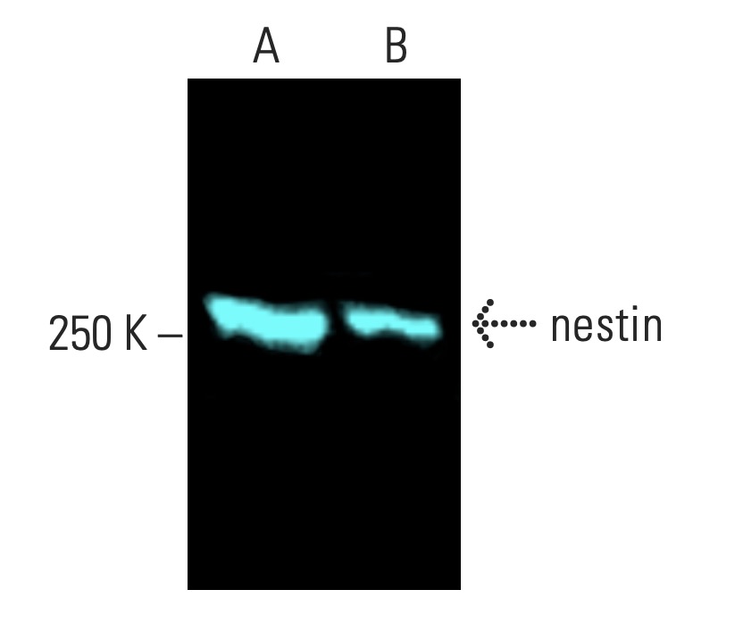 nestin Antibody (10c2) | SCBT - Santa Cruz Biotechnology