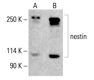 nestin-antibody-10c2-western-