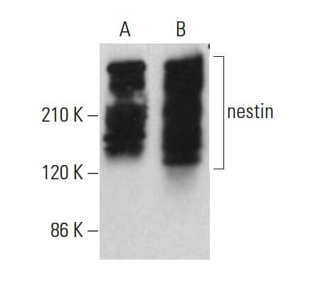 Anti Nestin Antibody 2q178 Scbt Santa Cruz Biotechnology