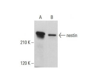 nestin Antibody (5C93) - Western Blotting - Image 376365 