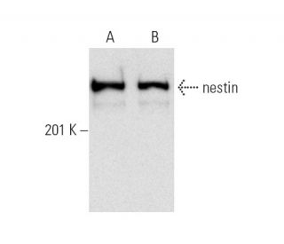 western blotting image from recommended nestin (10c2) monoclonal antibody replacement. Image 7162