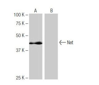 Net Antibody (11G9) - Western Blotting - Image 65015SAM Transcription Activation: SAM system utilizing dCas9-VP64, MS2-P65-HSF1, and sgRNA for precise gene transcription activation.