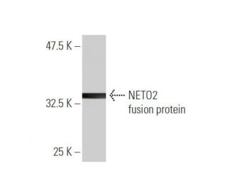 NETO2 Antibody (3E3) - Western Blotting - Image 350282