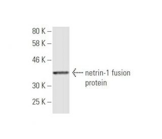 western blotting image from recommended netrin-1 (5H8) monoclonal antibody replacement. Image 349001