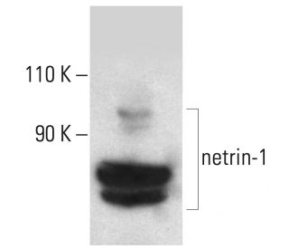 netrin-1 Antibody (A-7) - Western Blotting - Image 401711