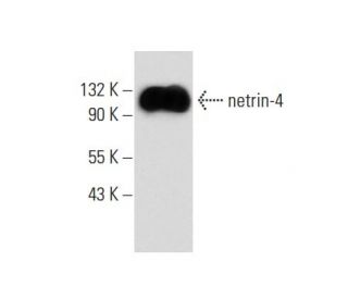 netrin-4 Antibody (A-7) - Western Blotting - Image 139086 
