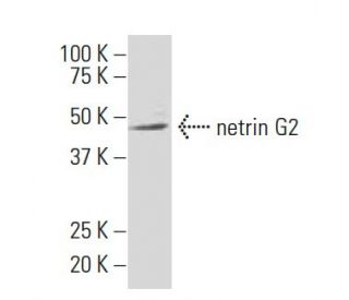 netrin G2 Antibody (Y-18L) - Western Blotting - Image 33707