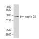 netrin G2 Antibody (Y-18L) - Western Blotting - Image 33707