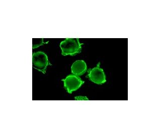 ErbB2/HER2 Antibody (9G6) - Immunofluorescence - Image 2735 