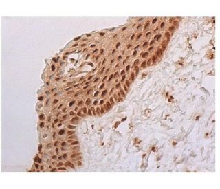 ErbB2/HER2 Antibody (A-2) - Immunohistochemistry - Image 352337 