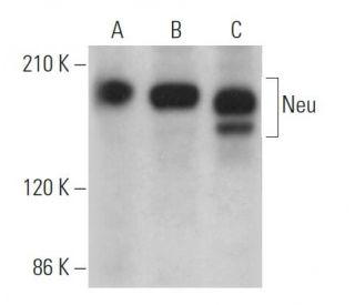 western blotting image from recommended ErbB2/HER2 (3B5) monoclonal antibody replacement. Image 362025