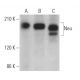 This polyclonal antibody has been discontinued. See our recommended <a href="neu-antibody-3b5">ErbB2/HER2 (3B5)</a> monoclonal antibody (sample data shown). western blotting image from recommended ErbB2/HER2 (3B5) monoclonal antibody replacement. Image 362025