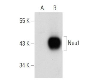 Neu1 Antibody (F-8) - Western Blotting - Image 109092Each CRISPR/Cas9 Knockout (KO) Plasmid product consists of a pool of 3 plasmids designed to ensure identification and cleavage of a specific gene for maximum knockout efficiency. Each plasmid encodes a unique 20 nt sequence derived from the GeCKO (v2) library.