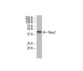 Neu2 Antibody (37Y) - Western Blotting - Image 33943The Double Nickase Plasmid features a U6 promoter for sgRNA expression, a 20 nt targeting sequence, and a gRNA scaffold to guide Cas9n. It includes a CBh promoter for Cas9n (D10A) and puromycin resistance, GFP for transfection verification, and nuclear localization signals (NLS). The 2A peptide allows co-expression of Cas9n and Puro from a single promoter, enabling precise genome editing with reduced off-target effects.