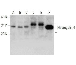 western blotting image from recommended Neuregulin-1/NRG1 (E-12) monoclonal antibody replacement. Image 353452