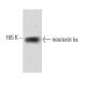 western blotting image from recommended neurexin Iα (17) monoclonal antibody replacement. Image 60379