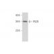 Neuro-2A Whole Cell Lysate: sc-364185. Western blot analysis of P5CR... 