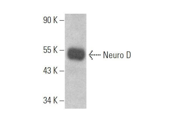 Neuro D Antibody (N-19) | SCBT - Santa Cruz Biotechnology