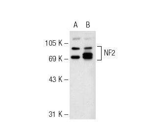 Neurofibromin 2/NF2/Merlin Antibody (E-2) - Western Blotting - Image 74427