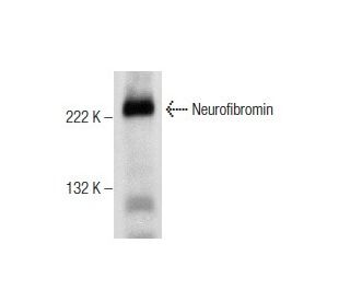 western blotting image from recommended Neurofibromin (H-12) monoclonal antibody replacement. Image 160900