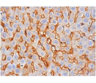 Neurofibromin Antibody (McNFn27a) - Immunohistochemistry - Image 284765 